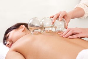 Cupping Acupuncture